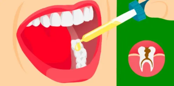 نحوه استفاده ار روغن میخک برای دندان